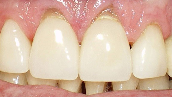 smile gallery